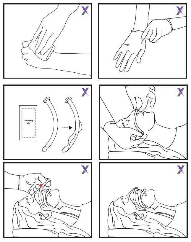 lightning x Nasopharyngeal nasal airway kit npa w/ 6 sizes 22FR, 24FR, 26FR, 28FR, 30FR, 32FR w/ 6 BZK cleansing wipes, 6 packs of lubricating lube jelly and a pair of nitrile exam gloves all in resealable zippered first aid med pod bag instructions printed on bag