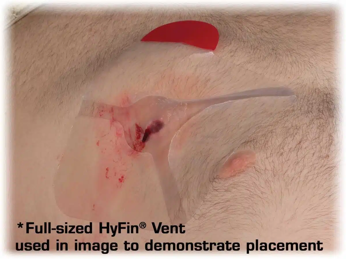 Hyfin Vent Chest Seal Twin Pack - Image 3