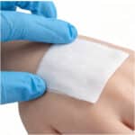 blood clotting gauze being applied to wound on hand