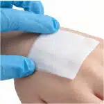 blood clotting gauze being applied to wound on hand