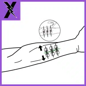 Med Pod | Zip Stitch Wound Closure Kit | LXSMK-ZIP - Image 9