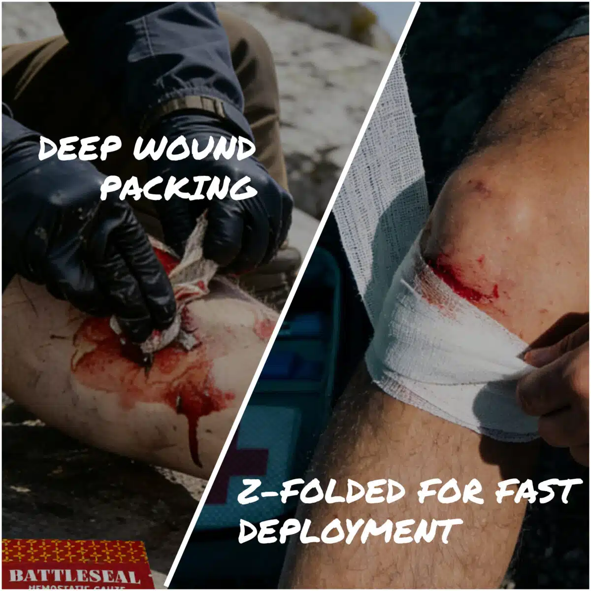 bloodied wounds being packed with hemostatic gauze